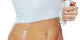 Lipoescultura gessada